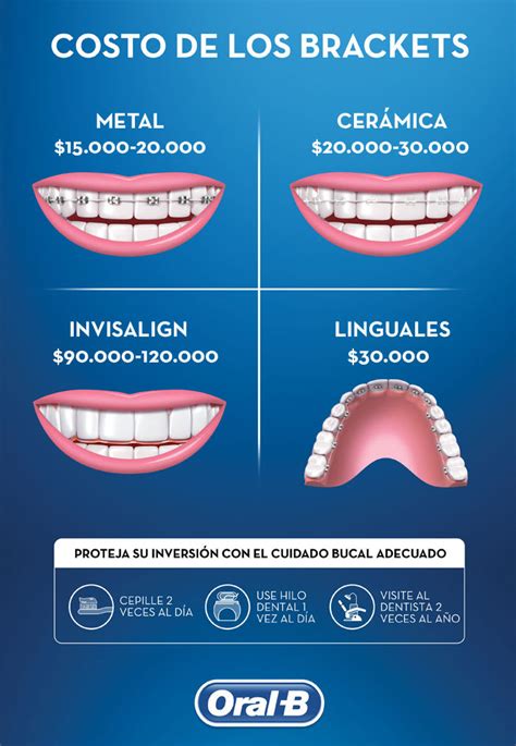 brackets de metal precio|cuanto cuesta un bracket.